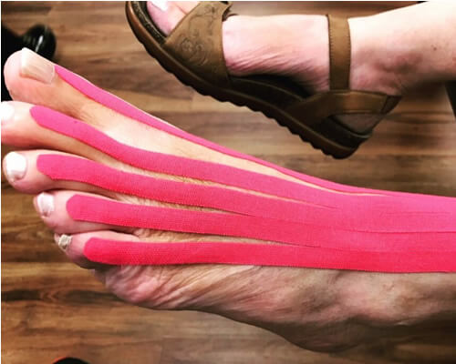 06-services-Kinesio-therapeutic 06-services-Kinesio-therapeutic